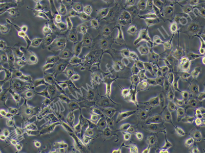 人肾透明细胞癌细胞；Caki-2 (STR)