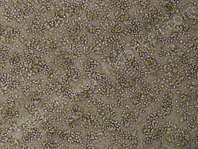 小鼠B细胞淋巴瘤细胞；A20