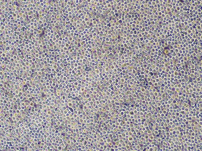 急性髓系细胞白血病细胞；KG-1A (STR)