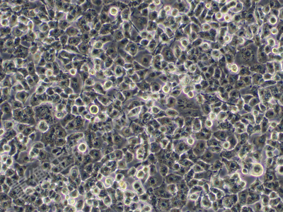 人大细胞肺癌细胞；NCI-H661 (STR)