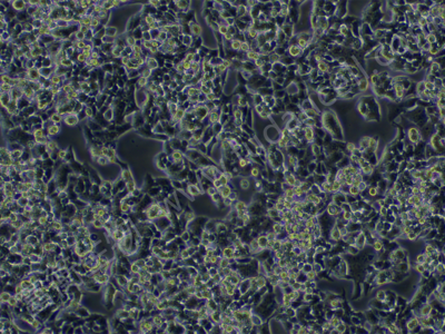 人肺腺鳞癌细胞； NCI-H520 (STR)