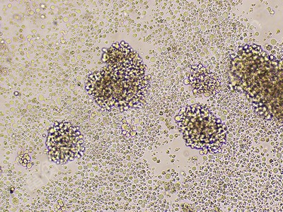 人恶性非霍奇金淋巴瘤患者的自然杀伤细胞；NK-92 (STR)