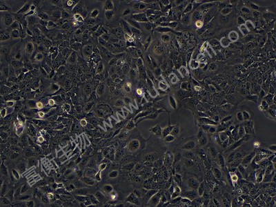 人膀胱上皮永生化细胞； SV-HUC-1 (STR)