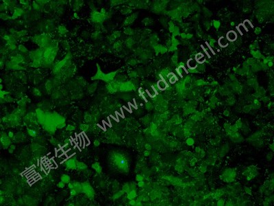 人肺癌细胞带绿色荧光； A549/GFP (STR)