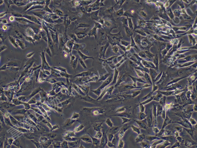 人滑膜肉瘤细胞； SW 982  (STR)