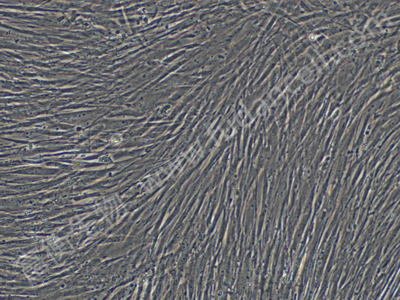 人肺成纤维细胞；HFL1 (STR)