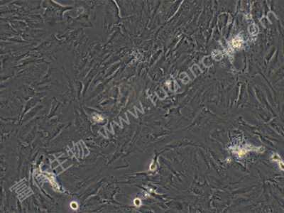 人肝癌细胞；SNU-387 (STR)