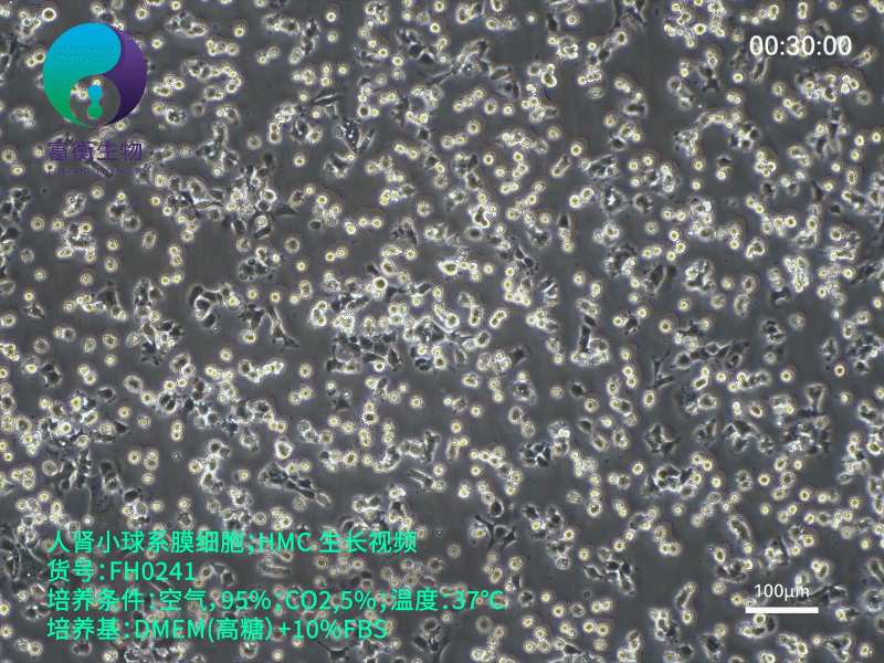 人肾小球系膜细胞；HMC (STR)