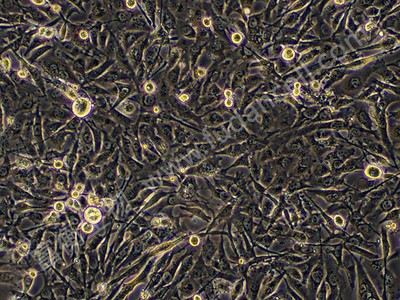 人乳腺导管癌细胞；BT-549 (STR)