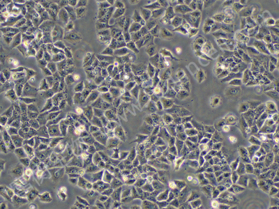 人大细胞肺癌细胞；NCI-H460 (STR)