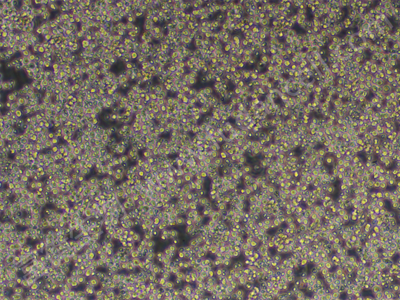 小鼠淋巴瘤细胞(NK靶细胞)；YAC-1 （种属鉴定）