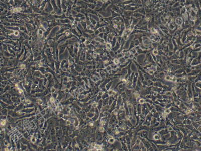 人胃癌细胞（未分化）带荧光素酶；HGC-27/LUC  (STR)