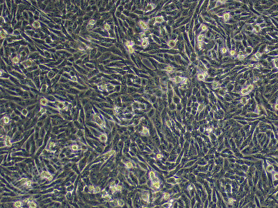 人黑色素瘤细胞株；A375 (STR)