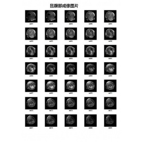 1.5T（25mm）核磁共振活體動物成像系統