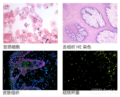 研究级正置荧光显微镜MHF200应用于广州某生物公司，助力医学研究