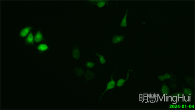 明慧倒置荧光显微镜应用于荧光活细胞观察