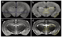 小动物磁共振成像系统在大鼠脑损伤评估中的应用