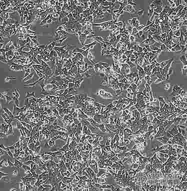 mcf-10a人正常乳腺上皮贴壁形式细胞