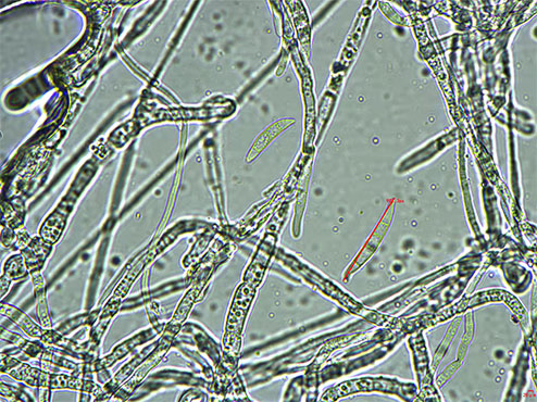 假菌丝和真菌丝图片