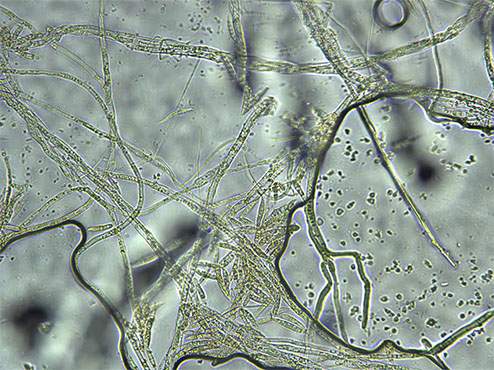 显微镜真菌菌丝图片图片