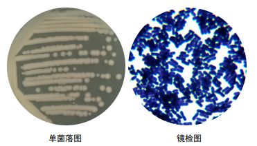 蜡样芽孢杆菌革兰染色图片
