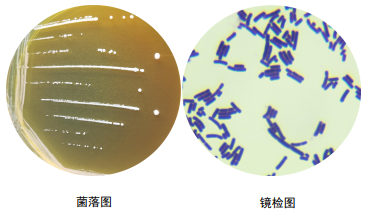 嗜酸乳杆菌菌落图片图片