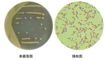 铜绿假单胞菌肺炎图片