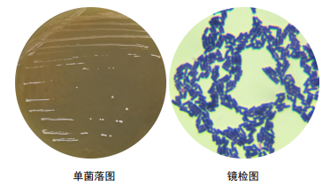 双歧杆菌显微镜图片