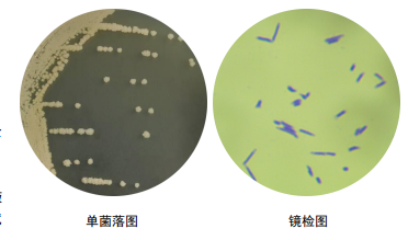 耻垢分枝杆菌手绘图图片