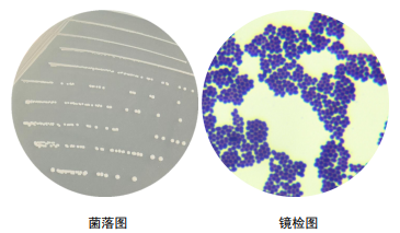 粪肠球菌镜检图片