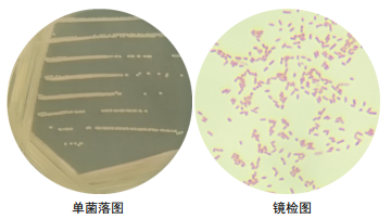 铜绿假单胞菌肺炎图片