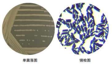 枯草杆菌芽孢染色图片