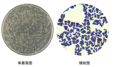 枯草杆菌芽孢染色图片