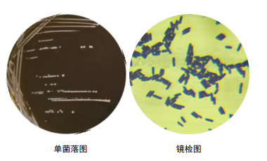 乳酸菌镜检图片图片